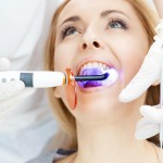 Consejos acerca del blanqueamiento dental