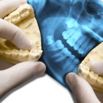 Zirconio vs titanio: ¿cuál es el mejor material para tus implantes dentales?