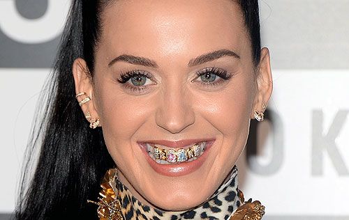 Grillz dental o joyas dentales: una moda peligrosa para tu boca