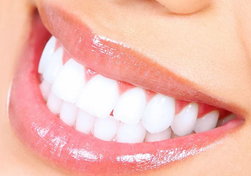 Es seguro y eficaz el blanqueamiento dental con luz ultravioleta?