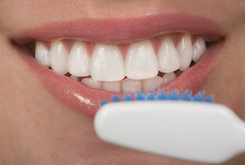 Carillas dentales ¿Qué cuidados requieren? - Clínica Blasi
