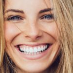 Tratamientos de estética dental para una sonrisa bonita