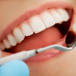 Cultivos periodontales para tratar la periodontitis