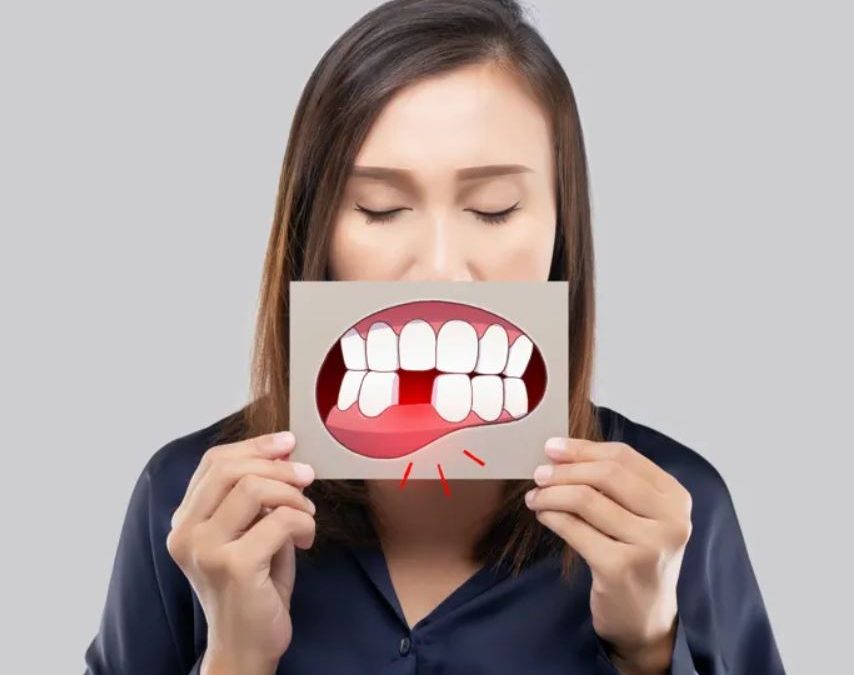 ¿Qué ocurre si faltan dientes?