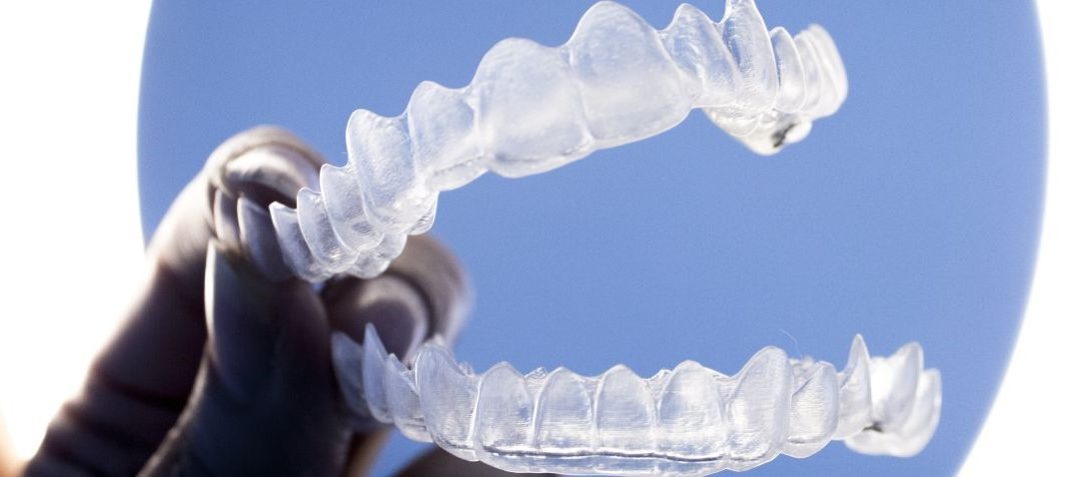 ¿Cómo se mueven los dientes en la ortodoncia invisible?