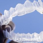 ¿Cómo se mueven los dientes en la ortodoncia invisible?